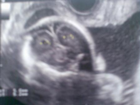 Echo du 2�me Trimestre (06/10/2008)