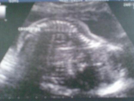 Echo du 2�me Trimestre (06/10/2008)