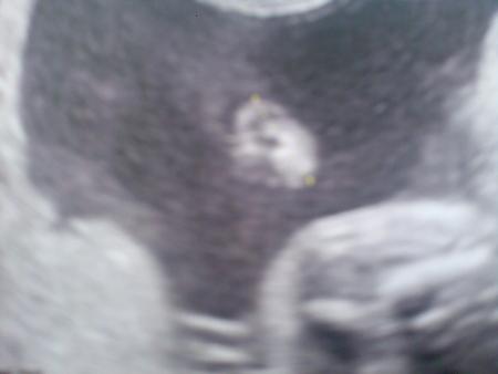 Echo du 2�me Trimestre (06/10/2008)