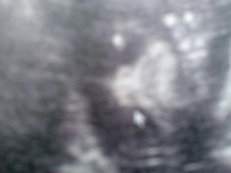 Echo du 2�me Trimestre (06/10/2008)