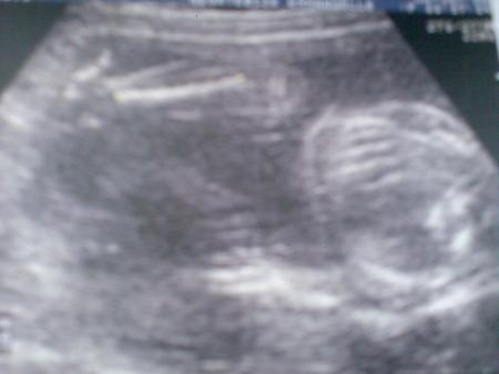 Echo du 2�me Trimestre (06/10/2008)