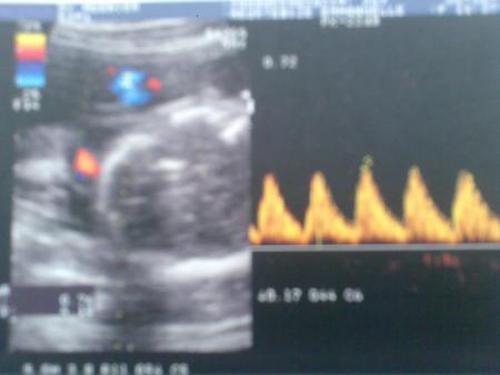 Echo du 2�me Trimestre (06/10/2008)