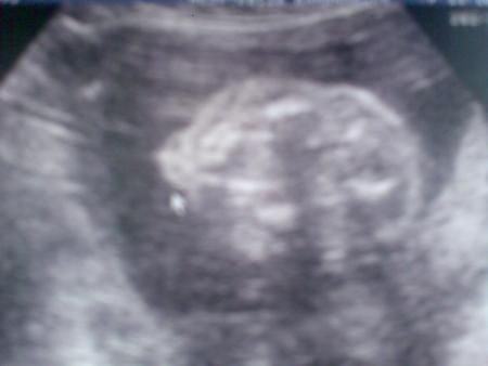 Echo du 2�me Trimestre (06/10/2008)